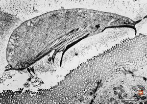 Giardia (Lamblia) intestinalis Giardia (Lamblia) intestinalis
